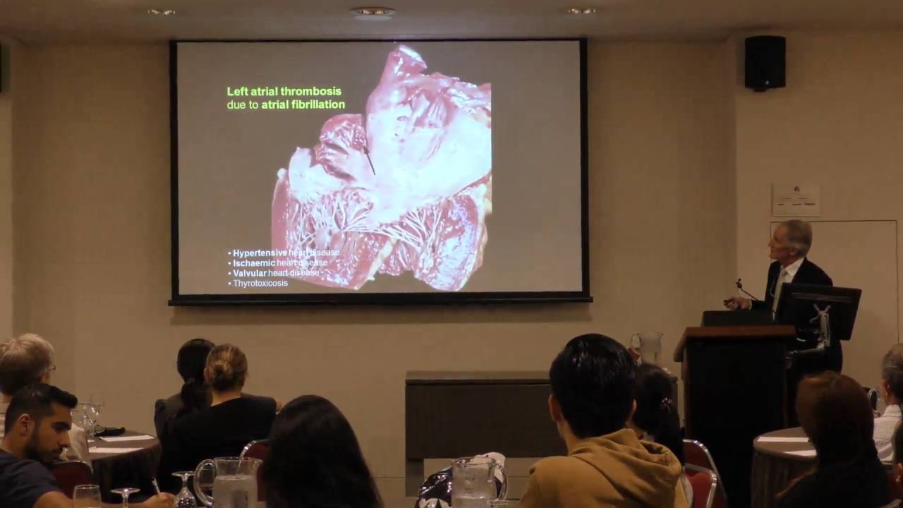 Lecture Part 1 April 2016 Stroke: Challenging a Looming Epidemic - Graeme J. Hankey