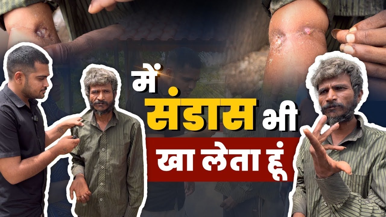 Me Toilet Bhi Kha Leta Hu Mera | Popatbhai Ahir | Team Pcf | Social Work￼