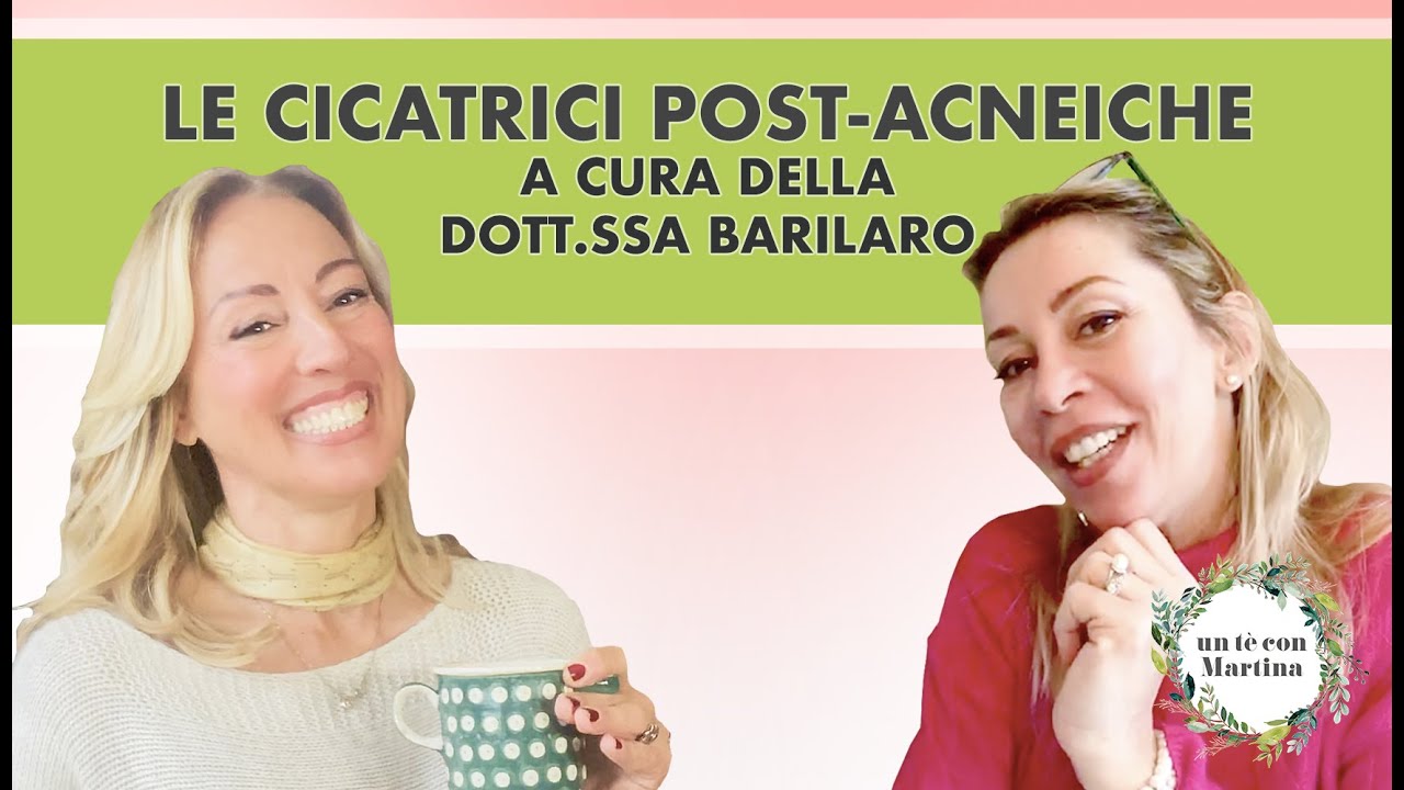 “Trattamento delle cicatrici post acne” - a cura della Dott.ssa Barilaro