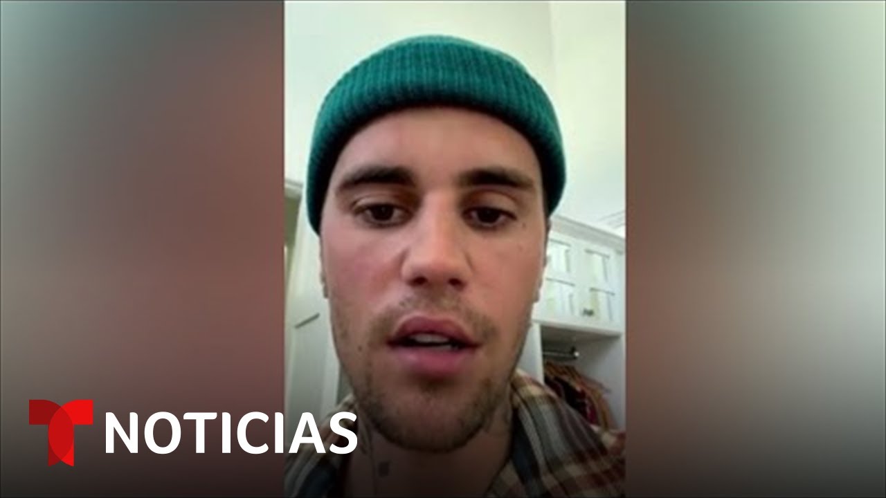 Estos son los síntomas del síndrome que sufre Justin Bieber | Noticias Telemundo