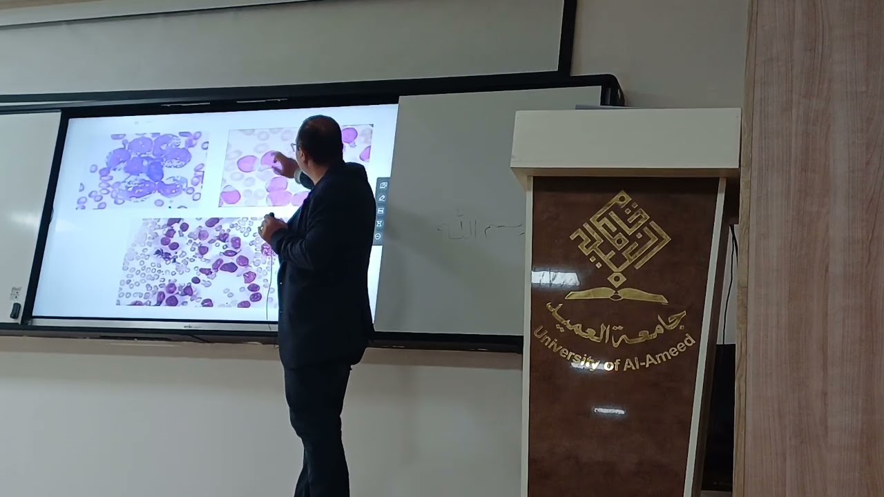 محاضرة الاطفال AML