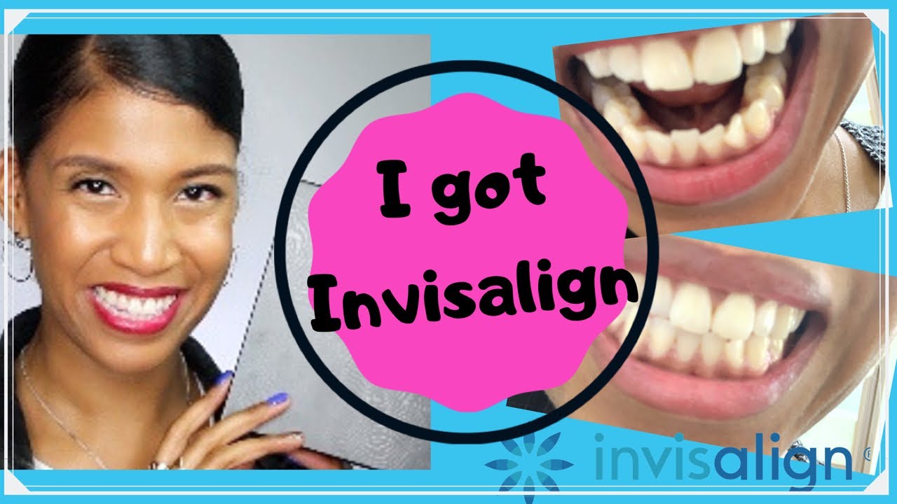 Invisalign Braces in Korea| Bright Dental Clinic