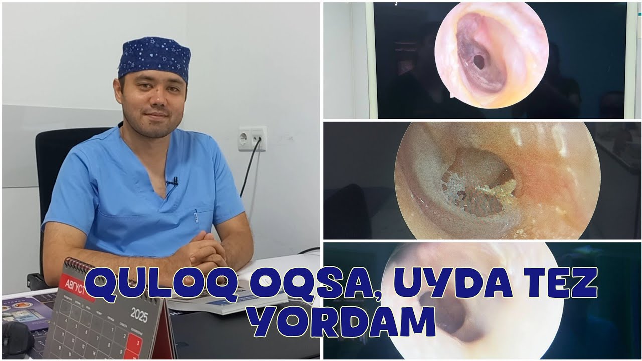 Quloq oqqanida bepul va uy sharoitida davolash usullari ( konsultatsiya olish uchun 970231545 )