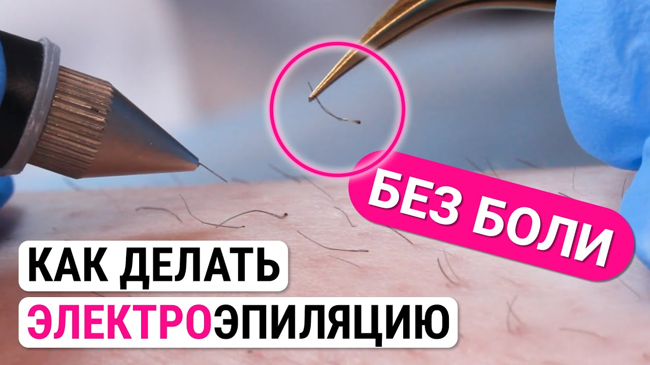 Урок №39. Техника проведения электроэпиляции: как делать электроэпиляцию без боли