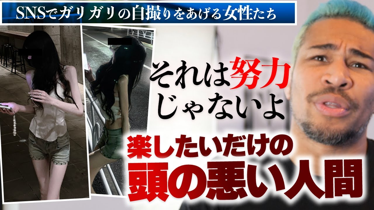 極端に細いマッチ棒のような女性の「私頑張った」とSNSでそれを称賛するヤツに思うこと【食と健康について】