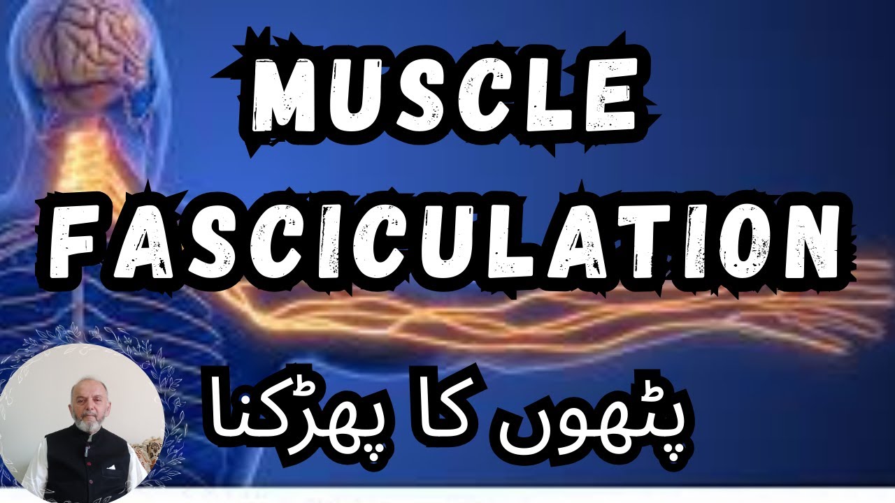 Muscle fasciculation | پٹھوں کا پھڑکنا