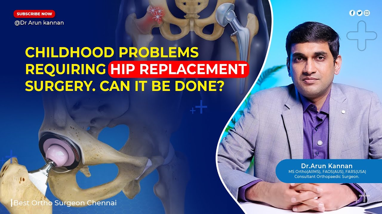 Is Hip Replacement Surgery Necessary in Childhood? | Dr. Arun Kannan