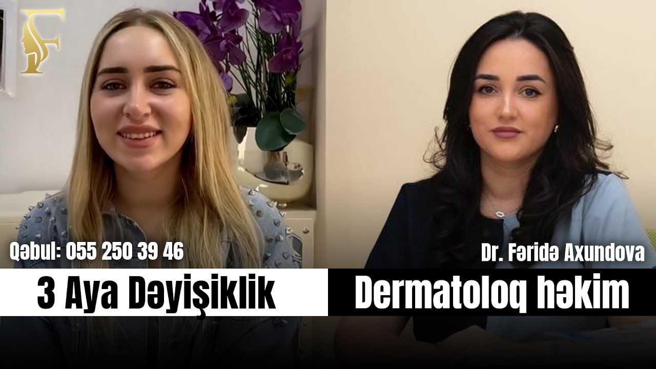 3 Ayda Sızanaqlar Necə Azaldı? Peşəkar Açıq Cavab