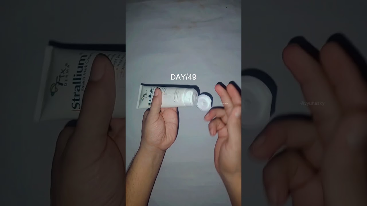 Day 49 Using Fix Derma Stretch Marks Cream &ndash; Real Results Update! 💯 #shorts