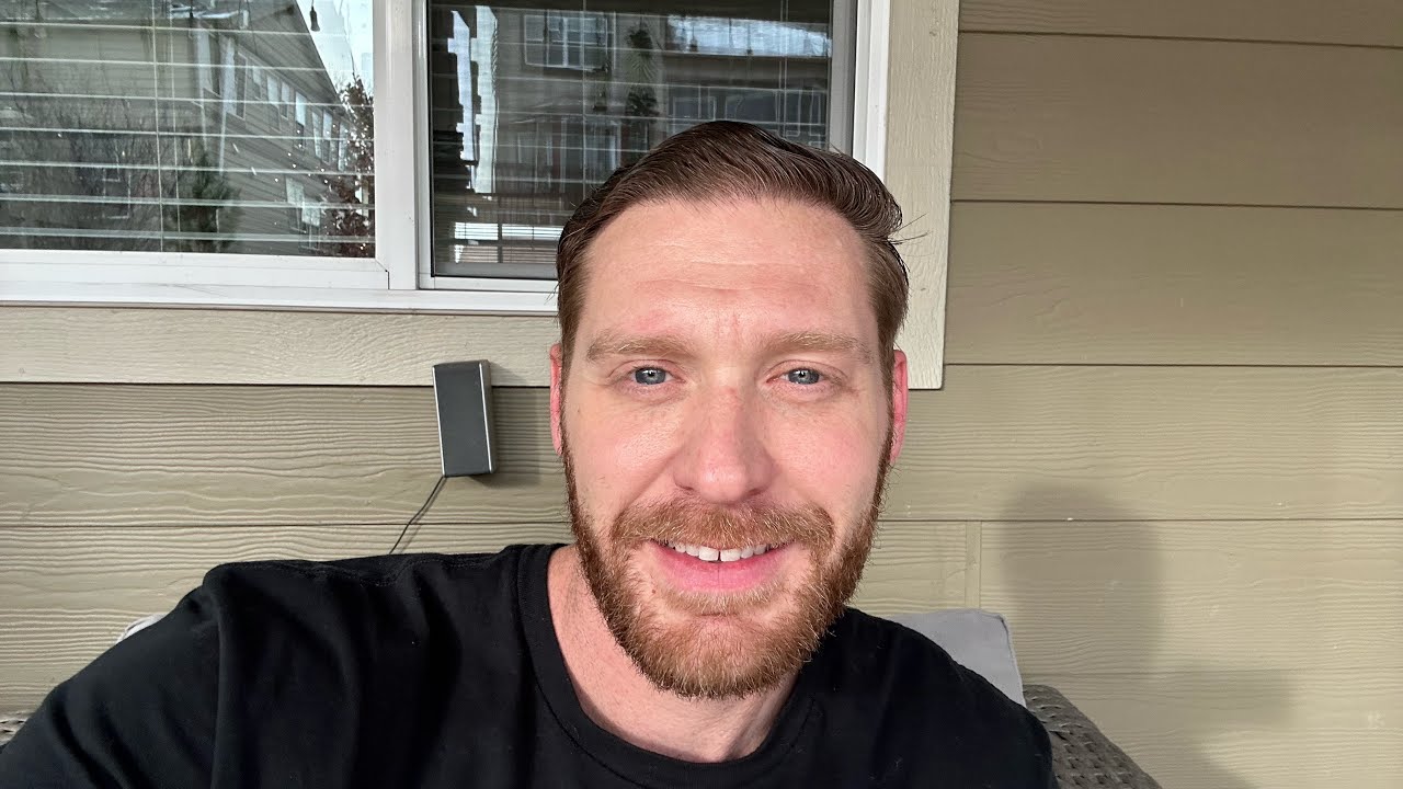 Month 9 Update Hair Transplant Cosmedica Turkey with Dr. Acar. 