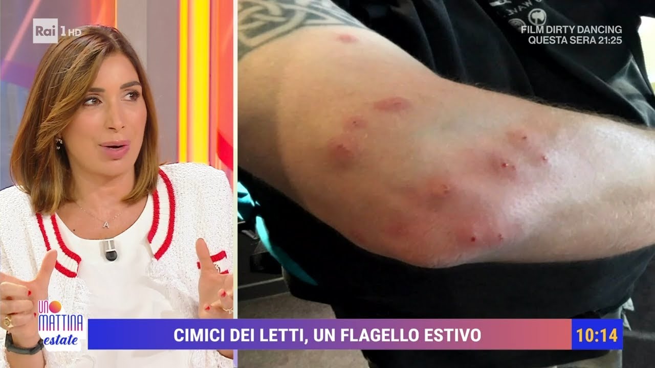 Le cimici nel letto! - Unomattina estate 31/07/2024