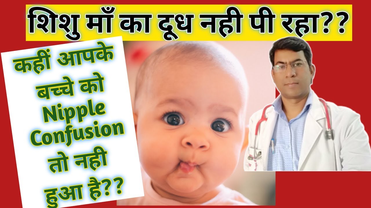 Nipple confusion क्या होता है? निप्पल कंफ्यूज़न से कैसे बचे? शिशु  के दूध न पीने के कारण