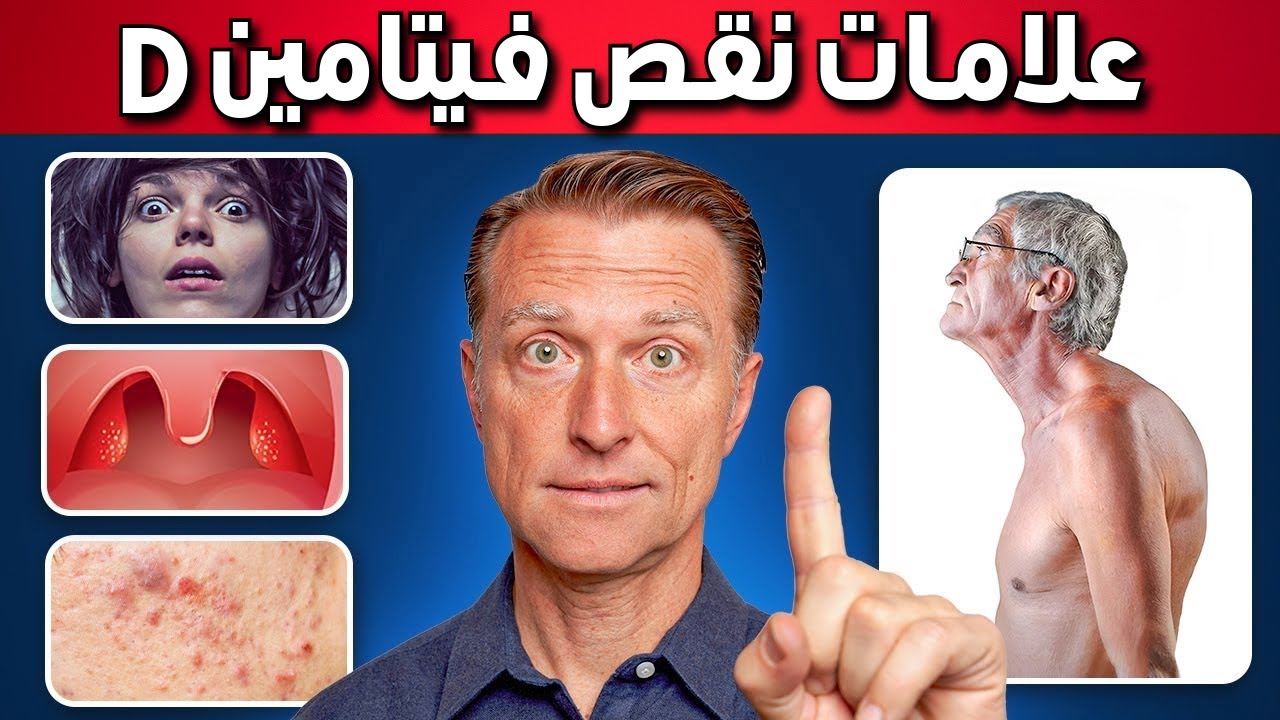 أعراض غريبة بسبب نقص فيتامين د لم تسمع بها من قبل