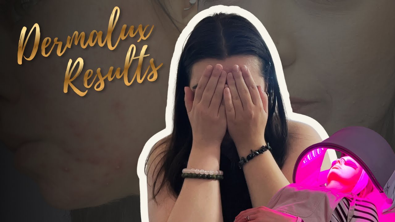 Dermalux Flex MD Review ⚡ Real Results, Real Skin Healing + My Honest Experience