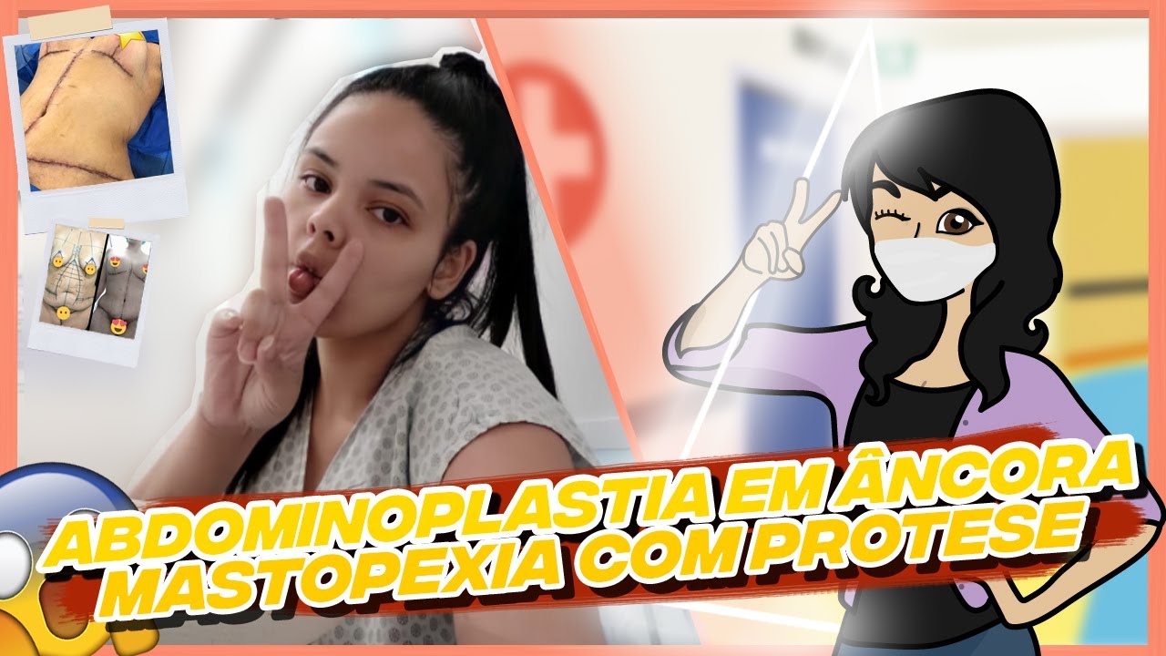 Cirurgia Reparadora - Abdominoplastia em âncora e mastopexia com prótese Vlog 1