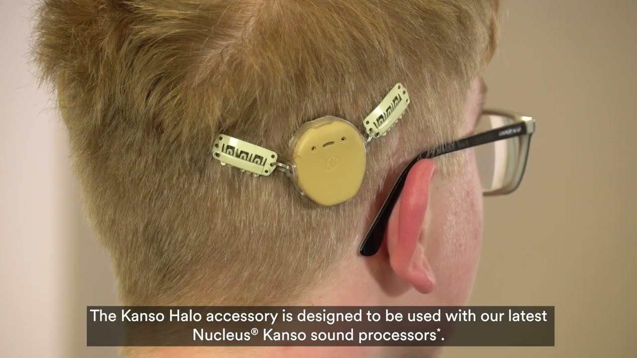 Cochlear&trade; Nucleus&reg; Kanso&reg; 3 | Halo Device