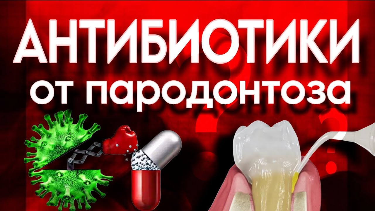 Антибиотики от пародонтоза. А оно надо?