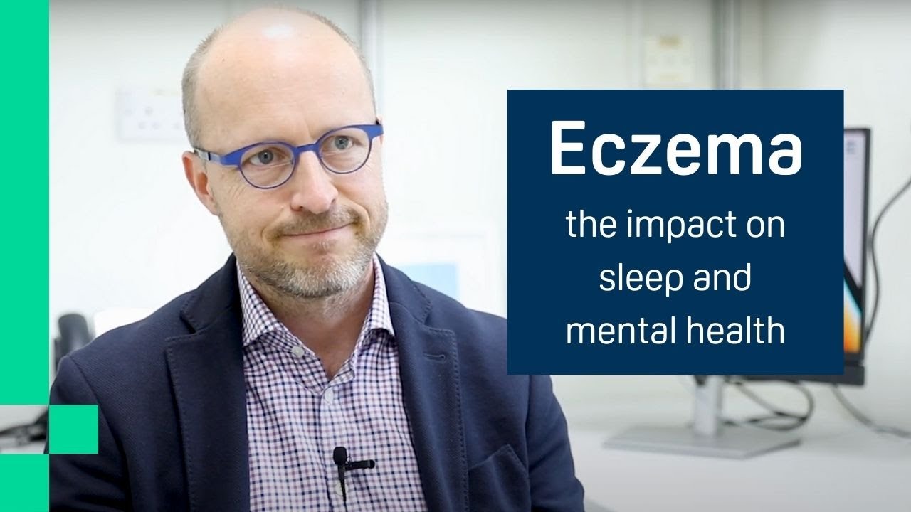 How eczema affects sleep and mental health in children - Professor Carsten Flohr
