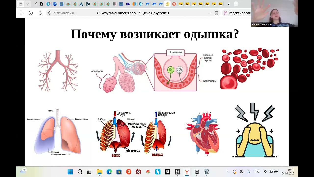 Красные флаги: когда онкопациенту нужен пульмонолог
