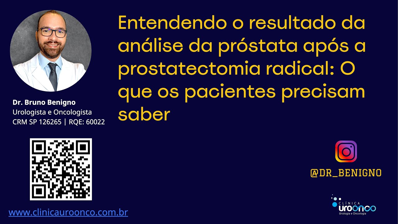 Entenda o resultado da análise da próstata após a prostatectomia radical: O que você precisa saber
