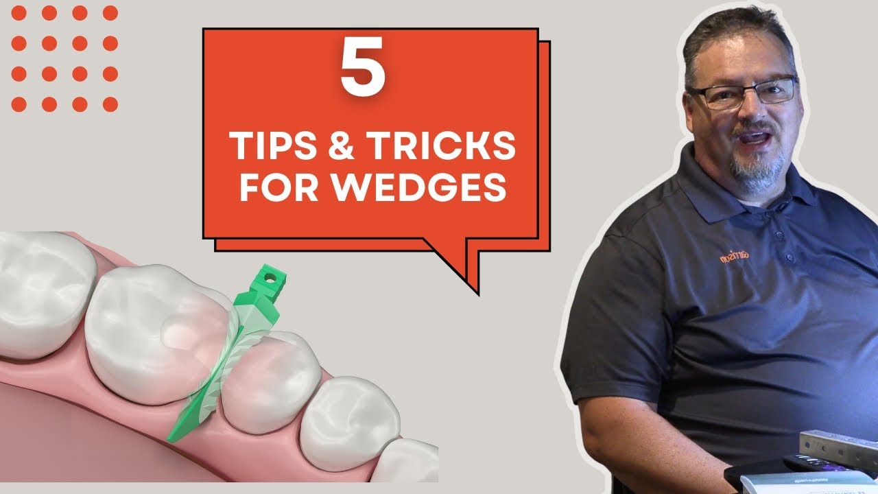 5 Wedge Tips & Tricks for Class II Composites