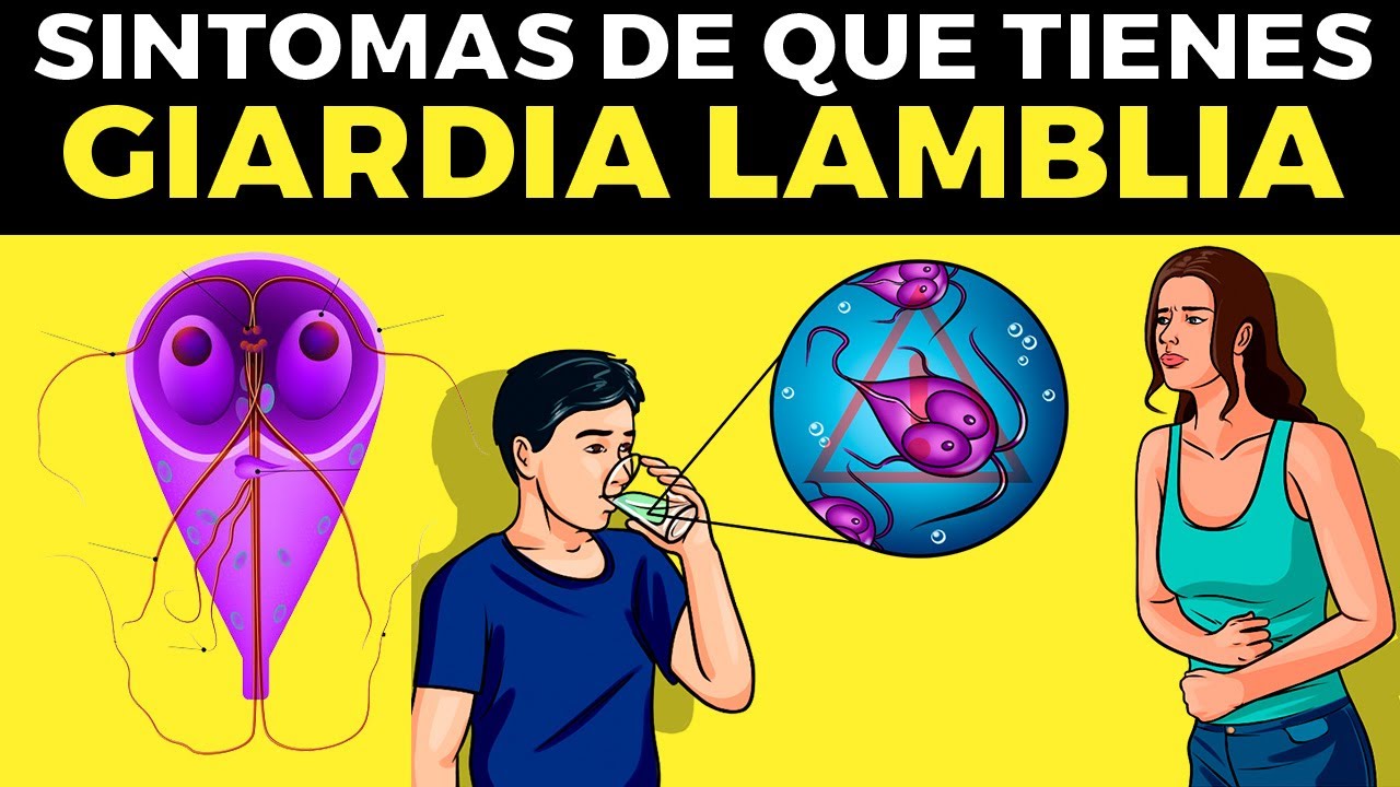 SÍNTOMAS DE QUE TIENES GIARDIA LAMBLIA