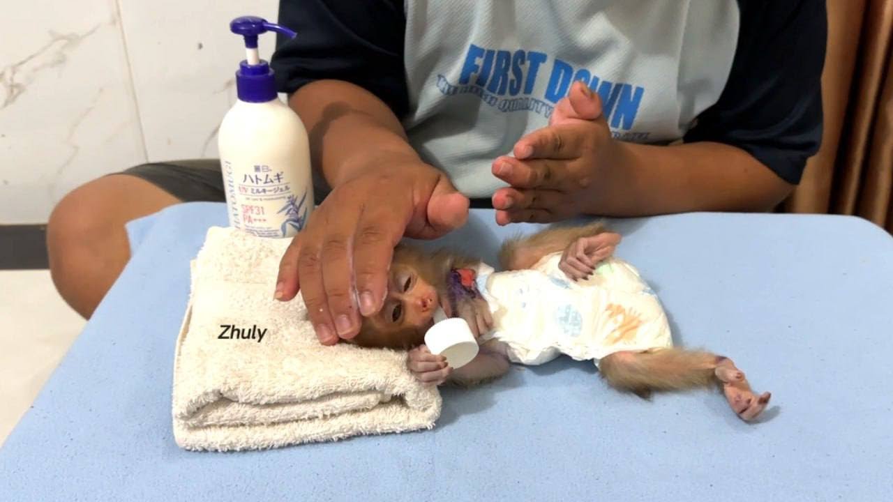 P…r Babi In ABD Fur & Skinn, Father Use Lotion For Helllp Her Skinn