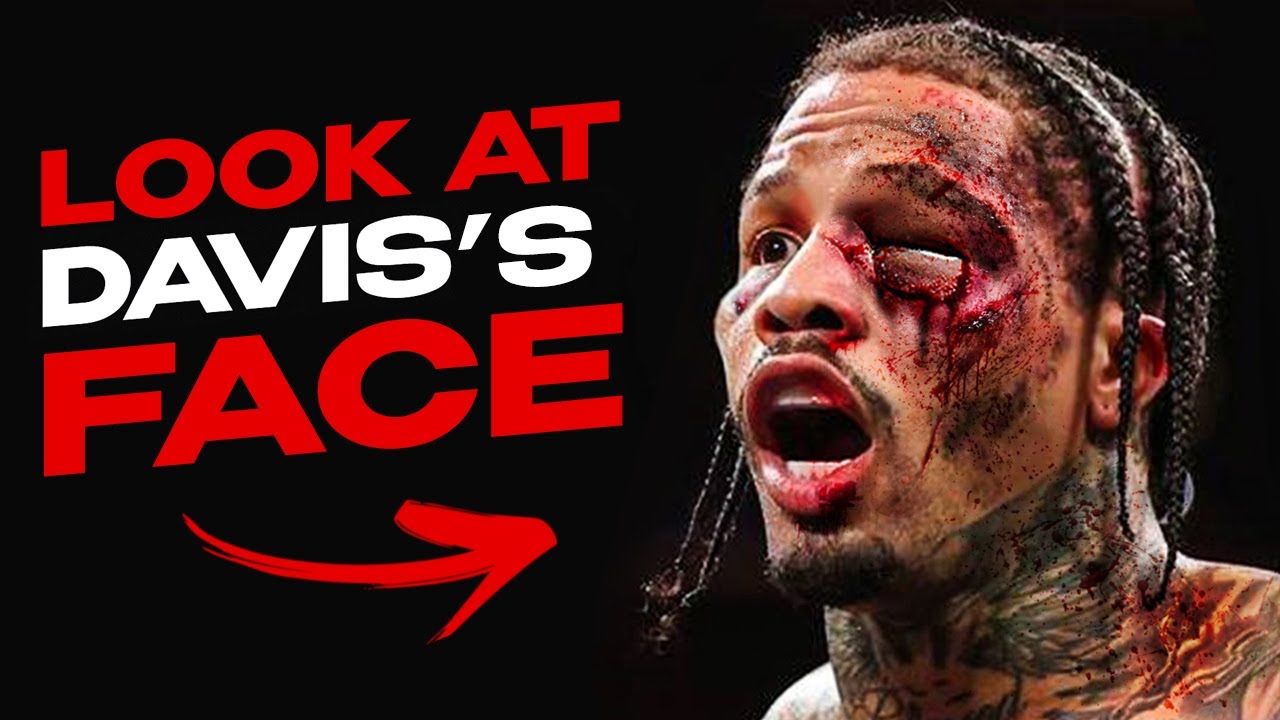 Gervonta Davis vs PURE VIOLENCE — Survival Mode