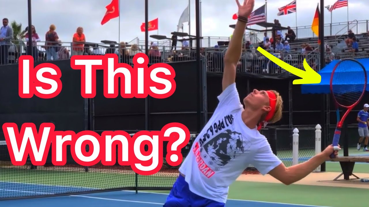 Should You ALWAYS Hit The Birthday Hat? (Tennis Serve Technique Explained)