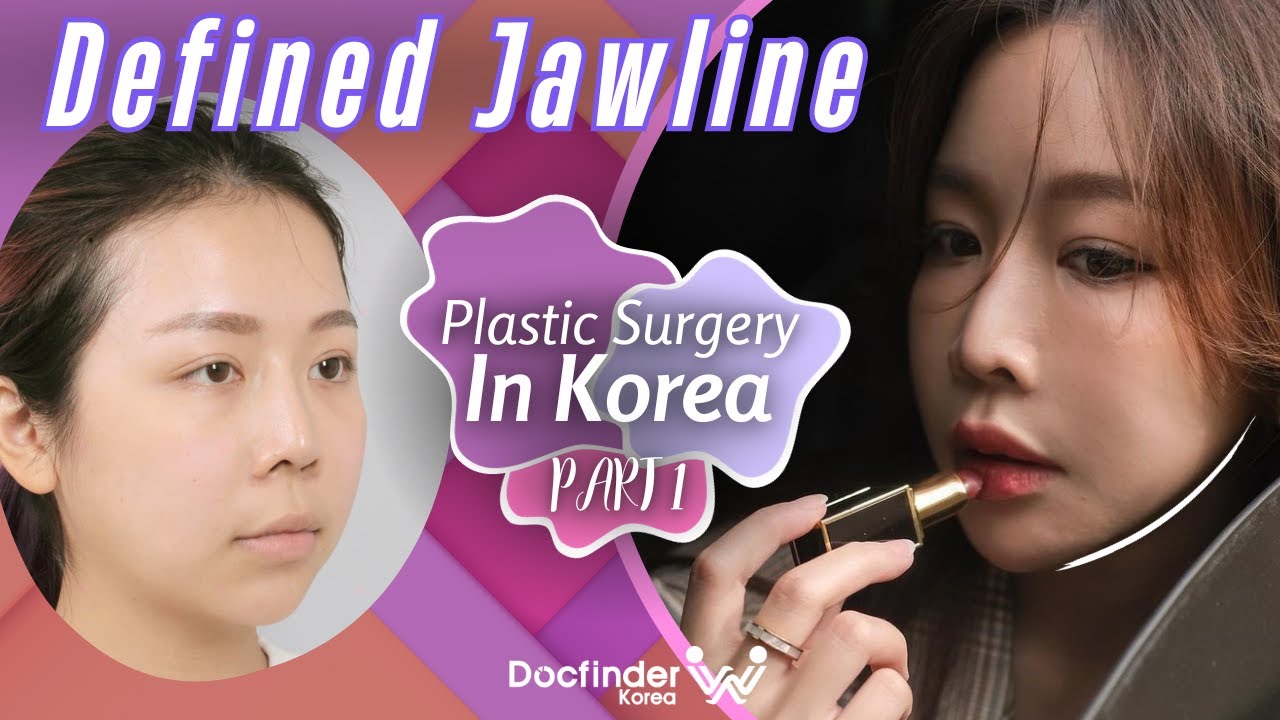 Best Plastic Surgery in Korea Review | Part 1