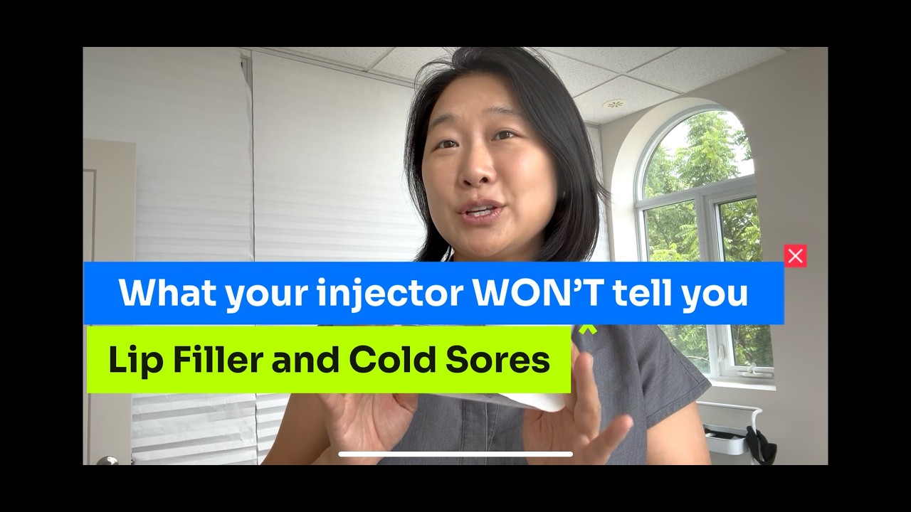 If you get cold sores and want lip fillers, don’t skip this!