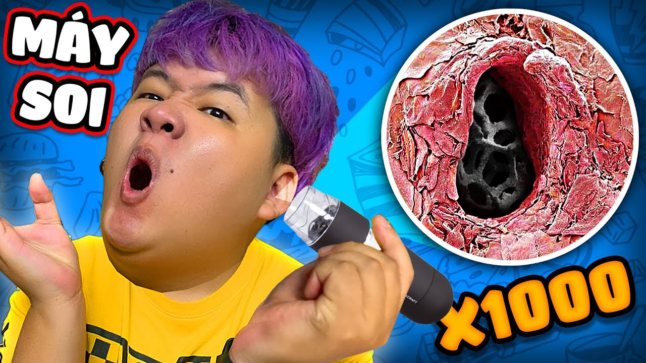 CÓ GÌ TRONG LỖ TAI SIÊU DƠ? Soi tất cả dưới kính hiển vi? (Mazk Phá Phách # 133)