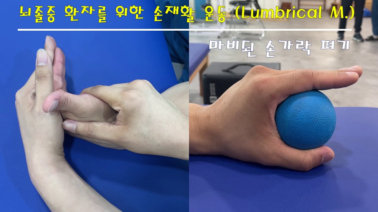 뇌졸중 환자를 위한 손재활운동 (Lumbrical M.). 마비된 손가락 펴기, 손 재활, 손가락 재활