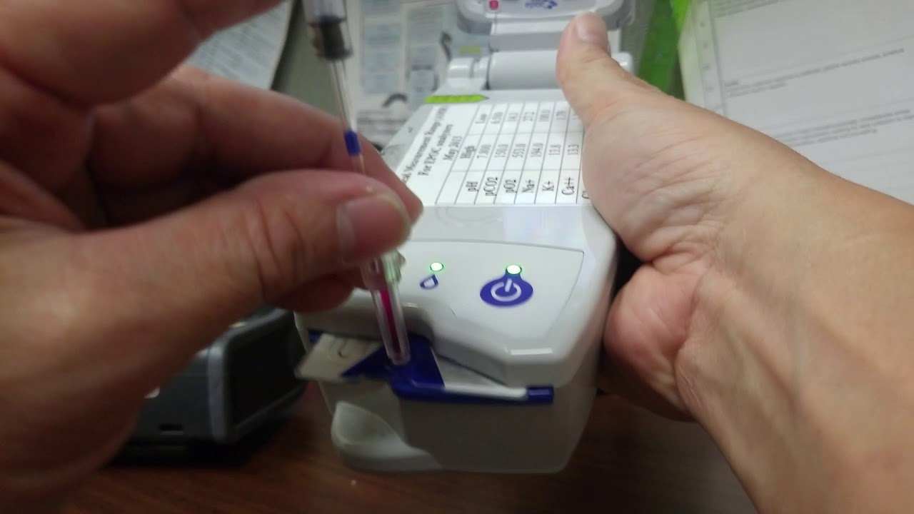 epoc® Blood Analysis System