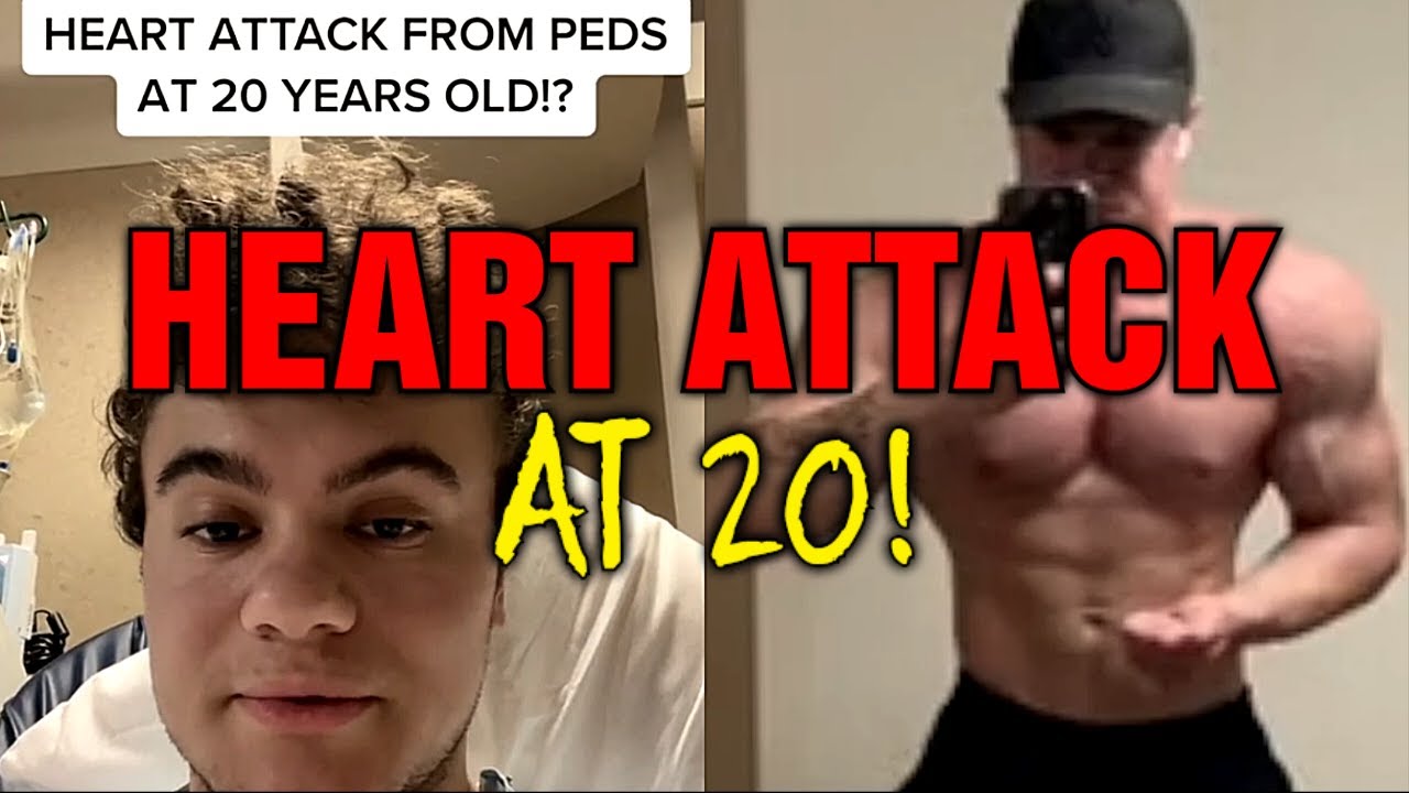 Heart Attack At 20 From Steroids