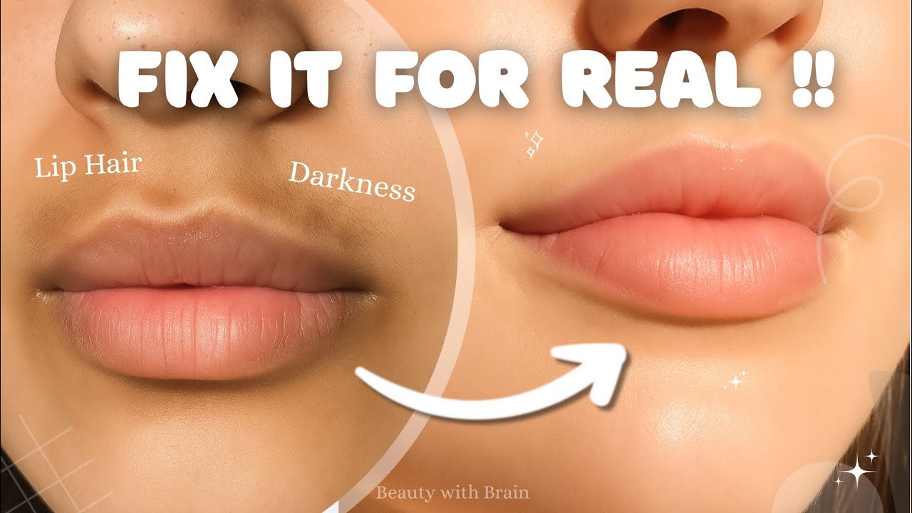 How to get rid of DARKNESS around the mouth 🍒 + Upper lip hair REMOVAL METHODS 🌸