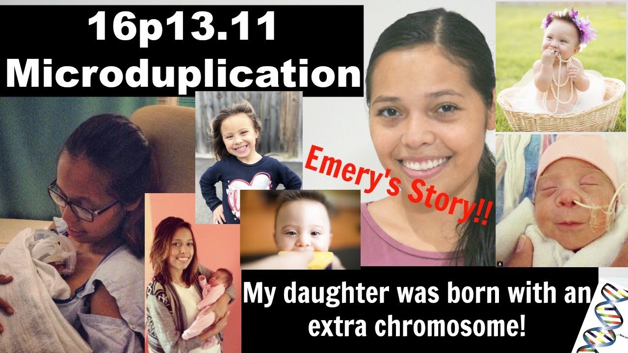 Testimony Tuesday: My Daughter was Born with an Extra Chromosome
