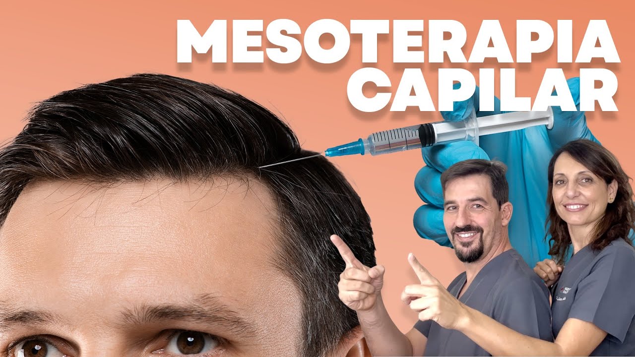 🔴 Mesoterapia Capilar ¿Estafa o efectiva?