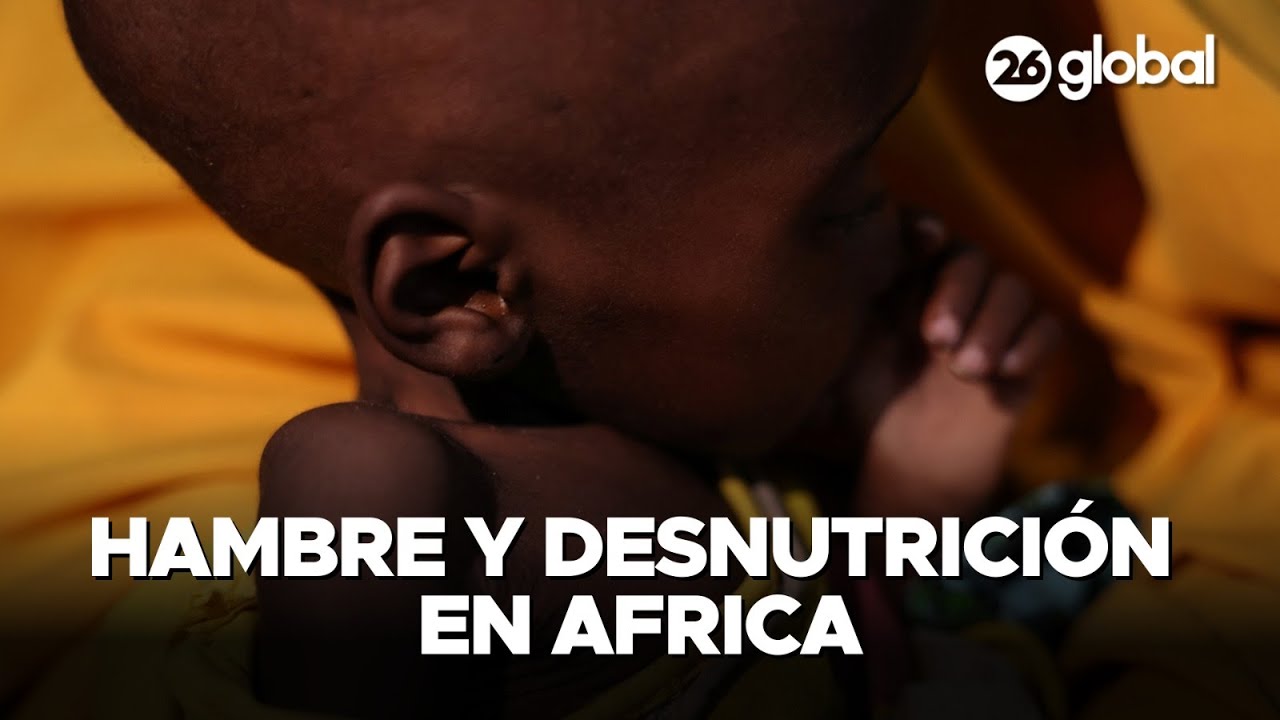 🔴 HAMBRE EN AFRICA | 2,3 MILLONES DE NI&Ntilde;OS cerca de la DESNUTRICI&Oacute;N | #26Global