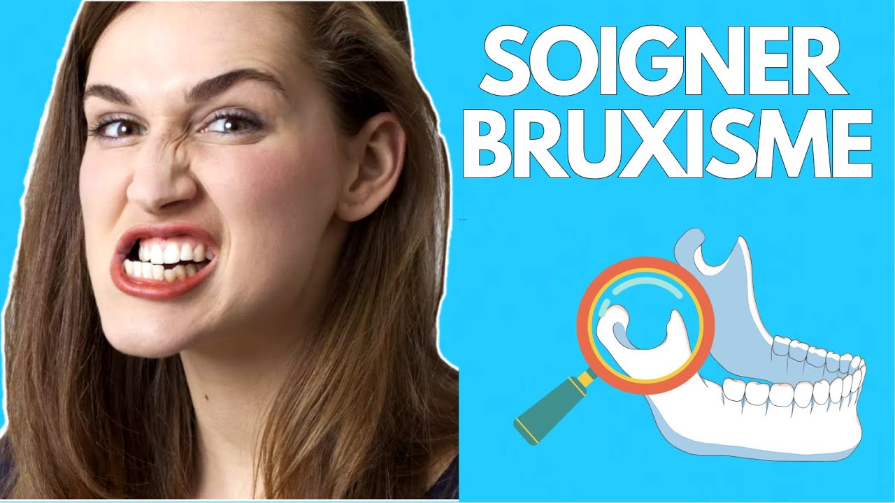 SOIGNER LE BRUXISME : GOUTTIÈRE, MÂCHOIRE QUI CRAQUE ?