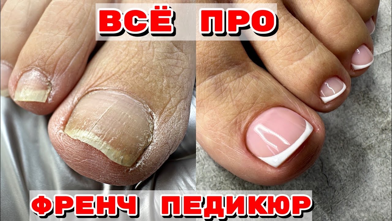 ПЕДИКЮР 🦶 Ногти сухарики 🦶 Френч на ногах 😍 Идеальные камуфляжи