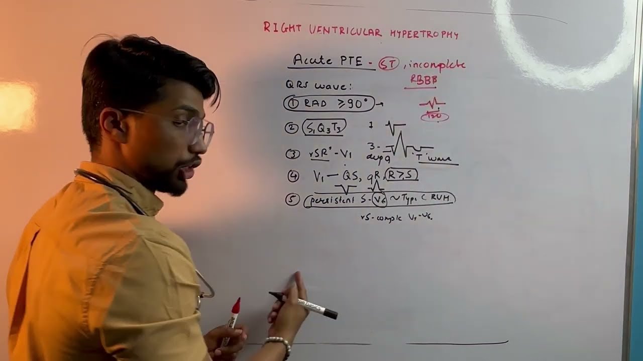 RIGHT VENTRICULAR HYPERTROPHY | ECG, ETIOLOGY AND TREATMENT | Dr. Devesh Bhargude | fit_doctor