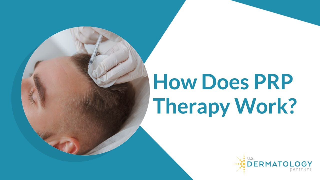 Platelet-Rich Plasma for Hair Loss | PRP Therapy in Tyler, TX