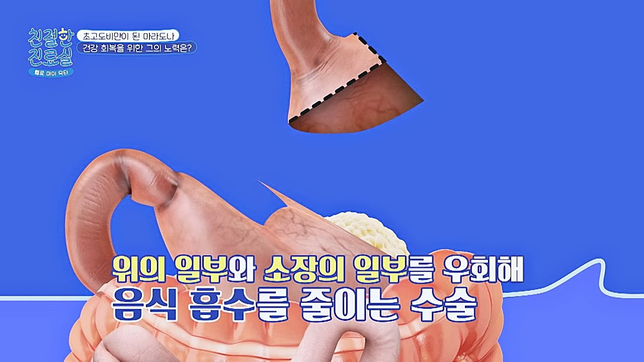 체중 감량을 위해 '위 우회 수술'을 두 번이나 받은 축구의 신💥 | 친절한 진료실 220회 | JTBC 251020 방송