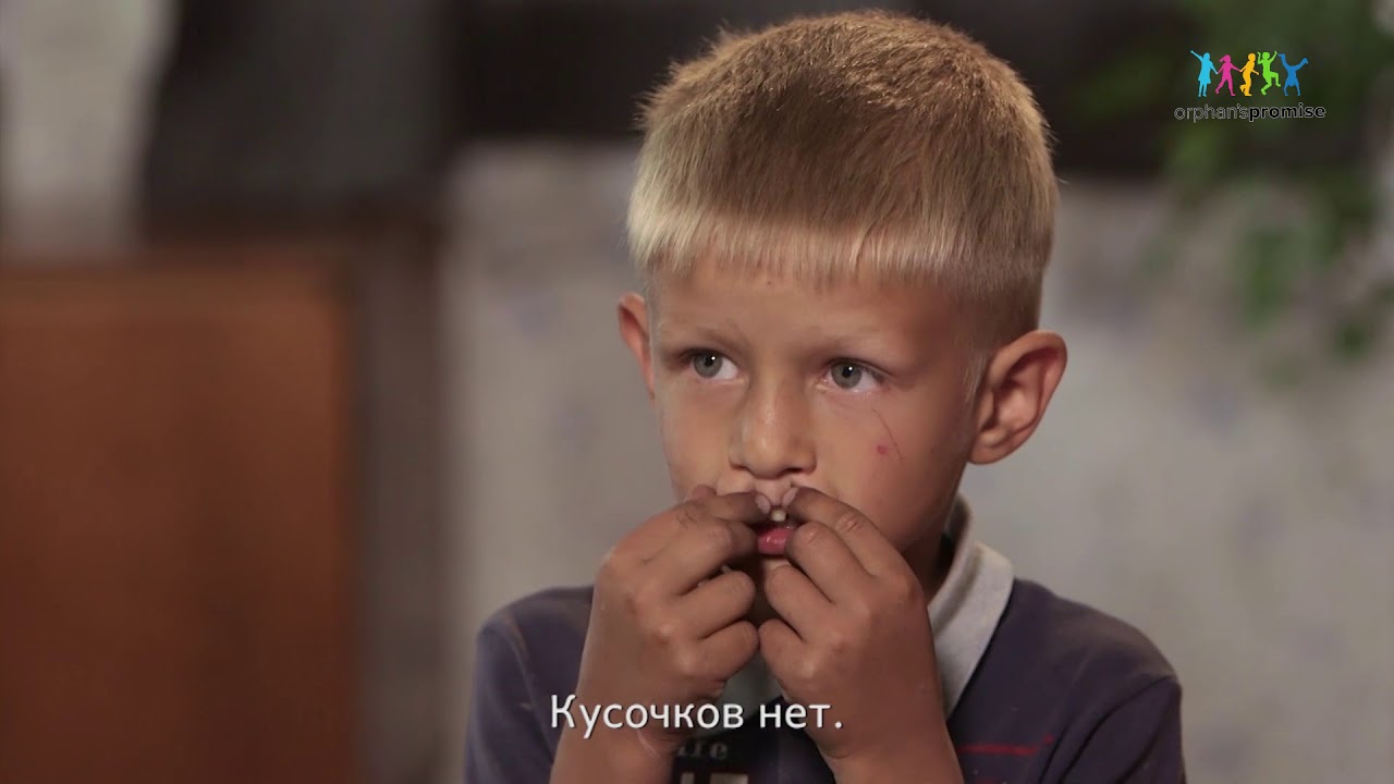 ЗАЯЧЬЯ ГУБА у ребенка: есть те, кто готовы помочь