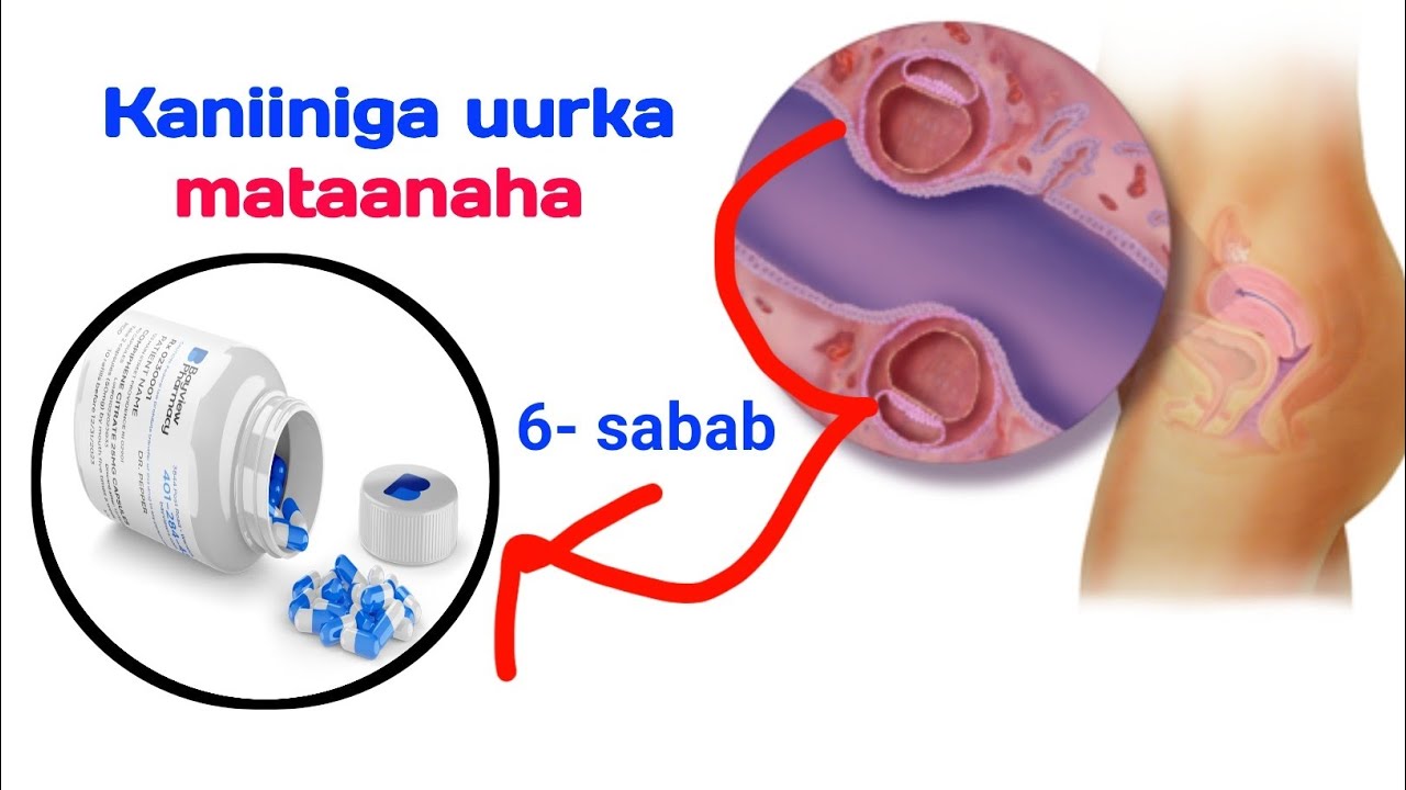 Kaniiniga uurka mataanaha ee Clomiphene citrate 6- sheey oo qasab tahay inaa ka ogaato ❤️✅👍