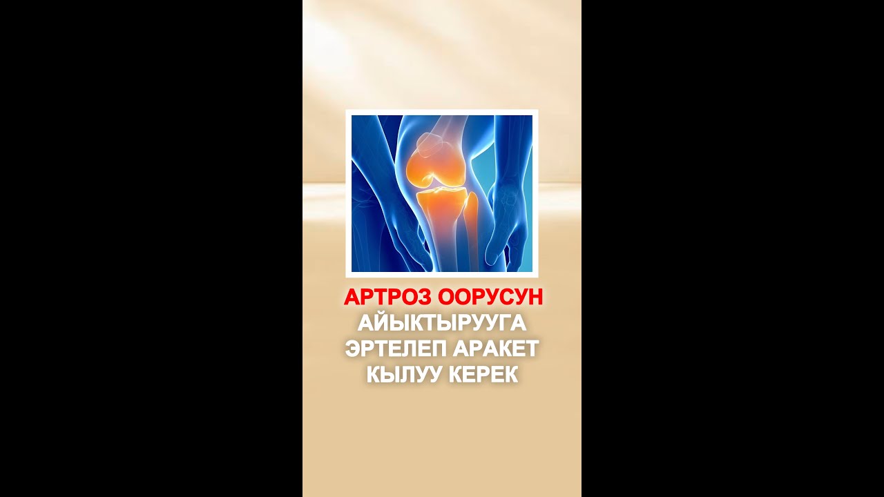 АРТРОЗ ООРУСУН АЙЫКТЫРУУГА ЭРТЕЛЕП АРАКЕТ КЫЛУУ КЕРЕК | Бекзат Болотбек