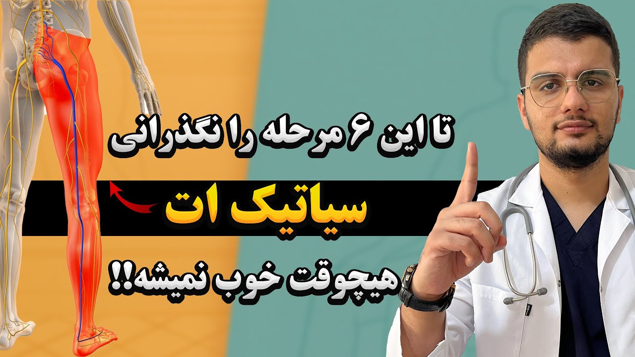 اگر میخای ۱۰۰٪ سیاتیکت خوب بشه باید این 6 مرحله را پشت سر بگذرونی!