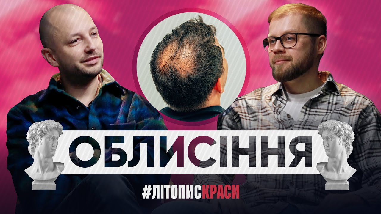 ЯК ПОВЕРНУТИ ВОЛОССЯ? Секрети трансплантації від Івана Баранова