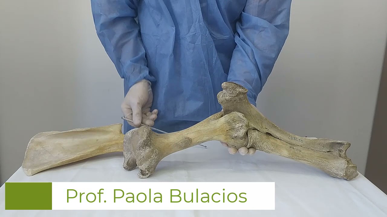 Huesos del brazo y antebrazo